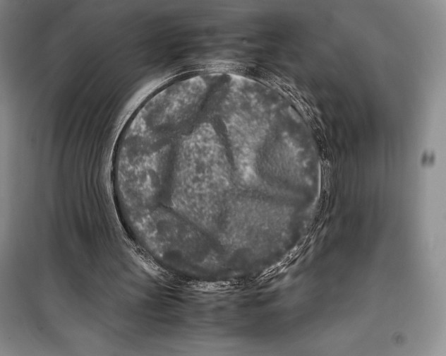 X0000099460147200806061137