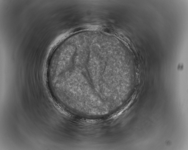 X0000099460149200806061137