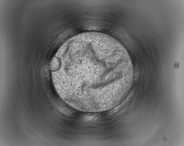 X0000099460175200806061137