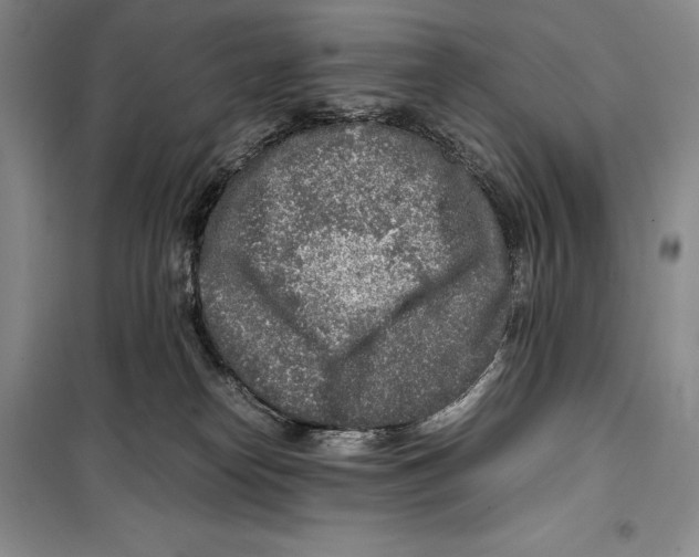 X0000099460182200806061137