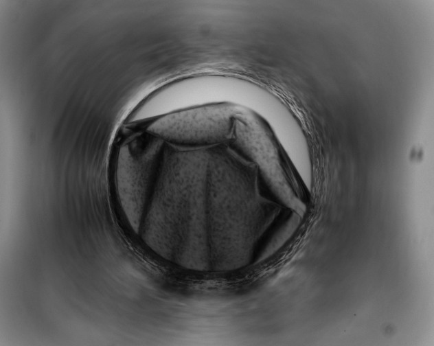 X0000099460196200806061137