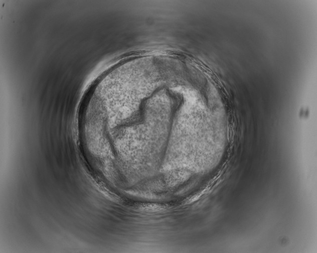 X0000099460198200806061137