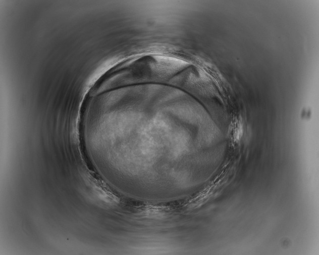 X0000099460292200806061135