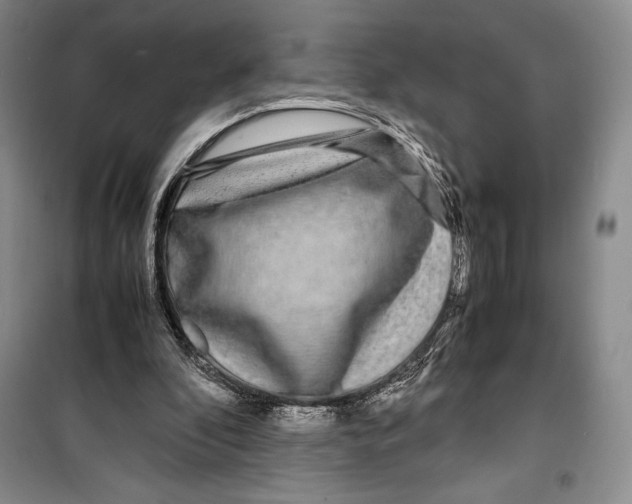 X0000099460296200806061135