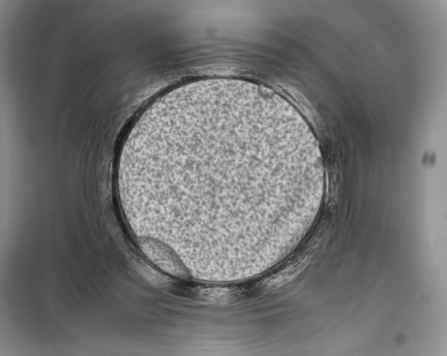 X0000099460301200806061135