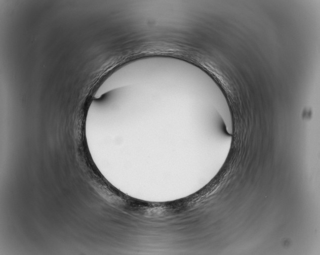 X0000099460309200806061135