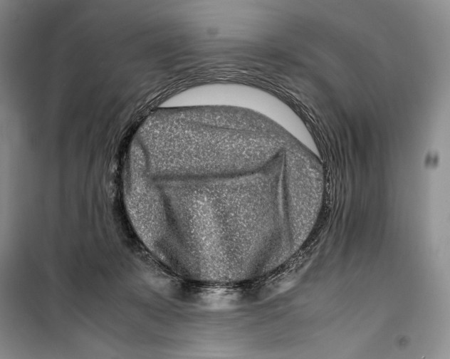 X0000099460319200806061135