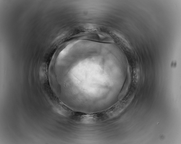 X0000099460320200806061135