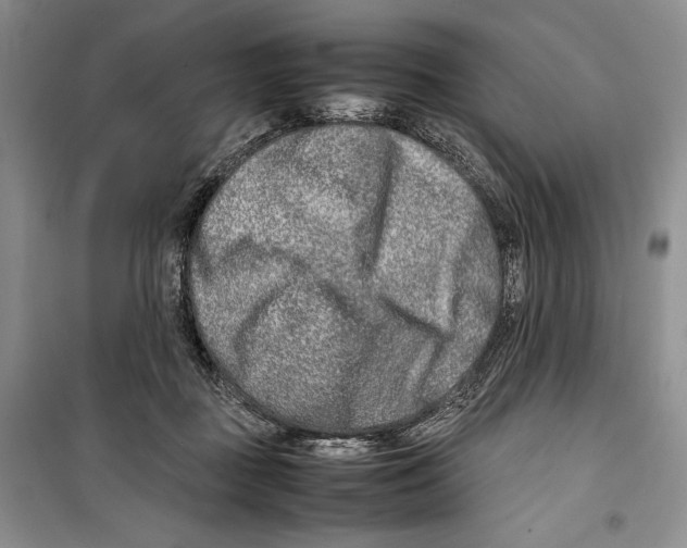 X0000099460363200806061134