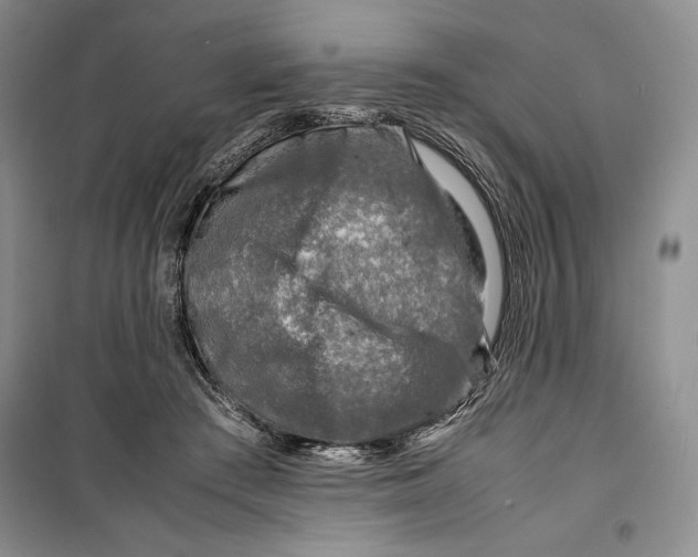 X0000099460409200806061134