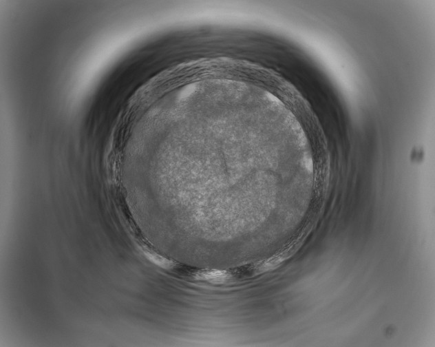 X0000099460431200806061133