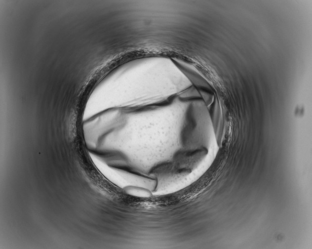 X0000099460496200806061132