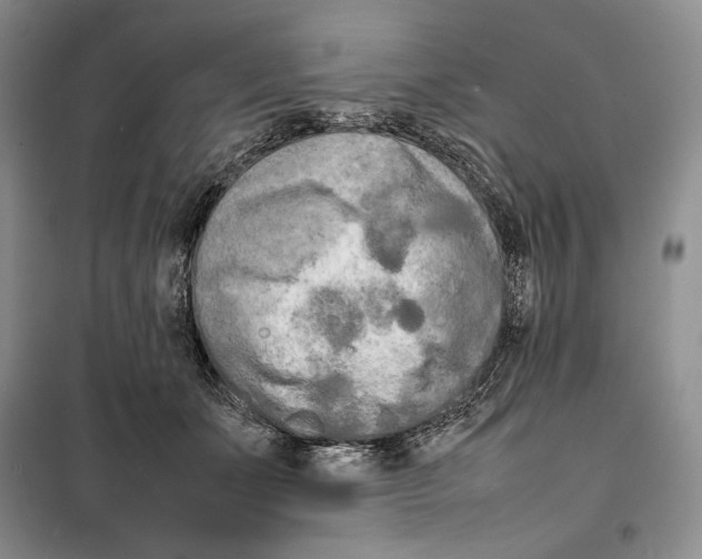 X0000099460511200806061132