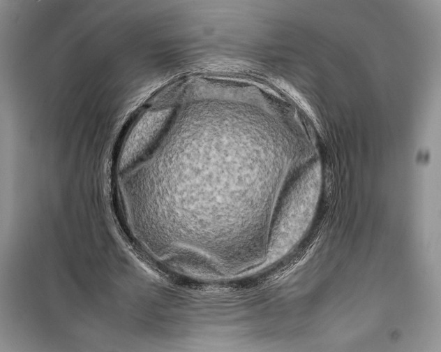 X0000099460581200806061131