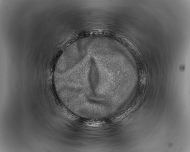 X0000099460661200806061130