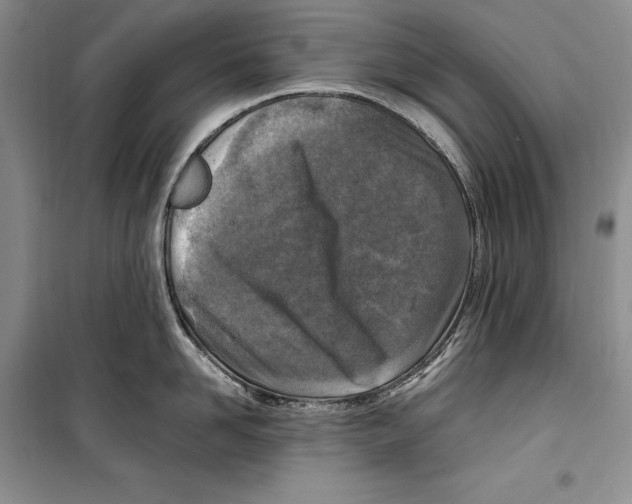 X0000099460958200806061126