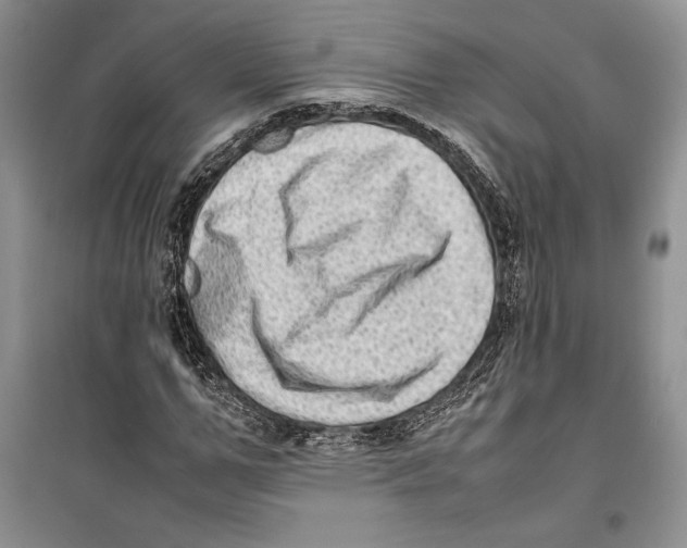 X0000099460967200806061125