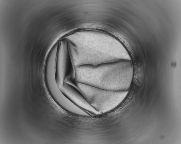 X0000099460992200806061125