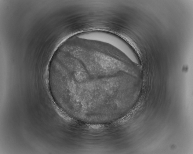 X0000099461031200806061124