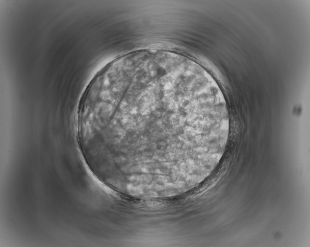 X0000099461095200806061123