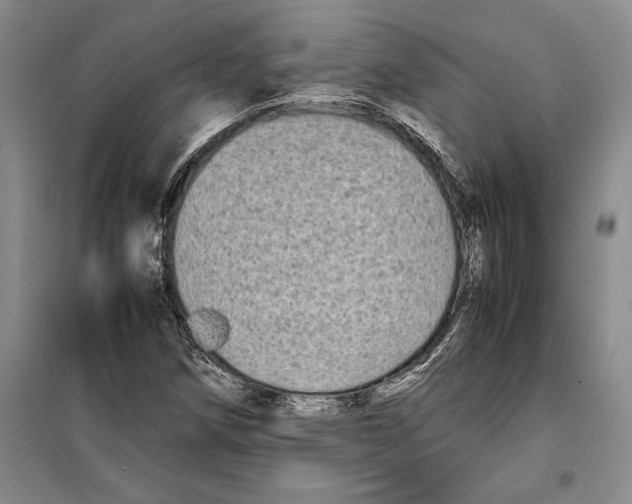 X0000099461258200806061121