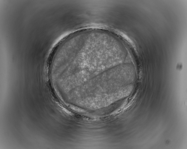 X0000099461310200806061119