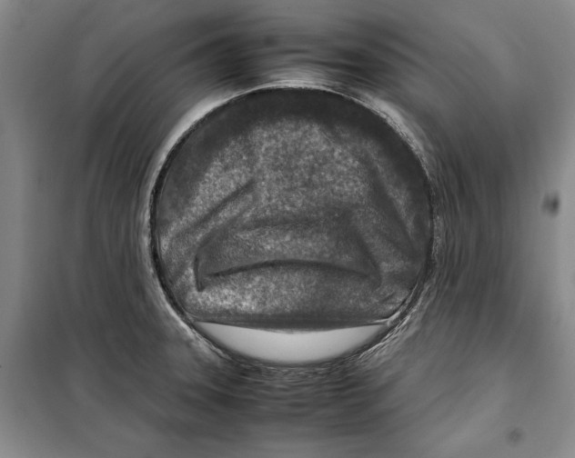 X0000099461331200806061120