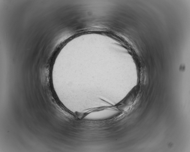 X0000099461402200806061118