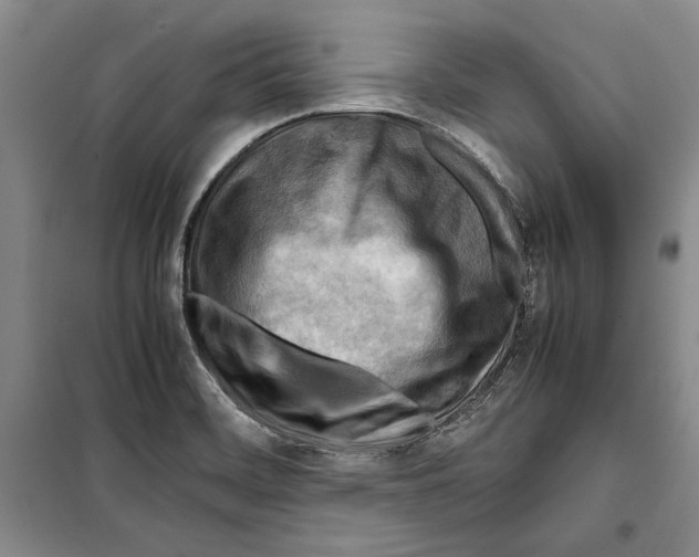 X0000099461468200806061118