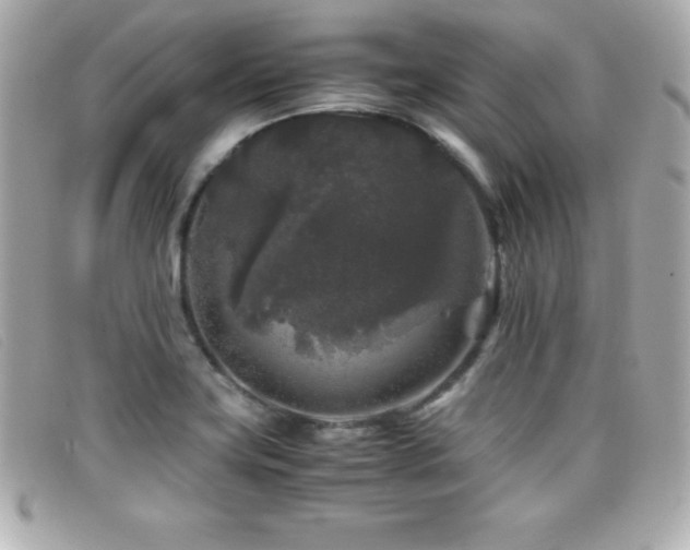 X0000099471419200805091537