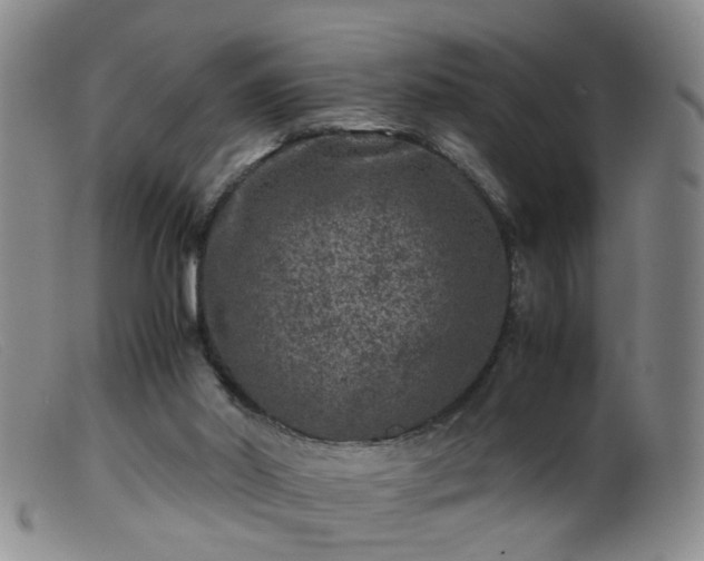 X0000099470014200805161122