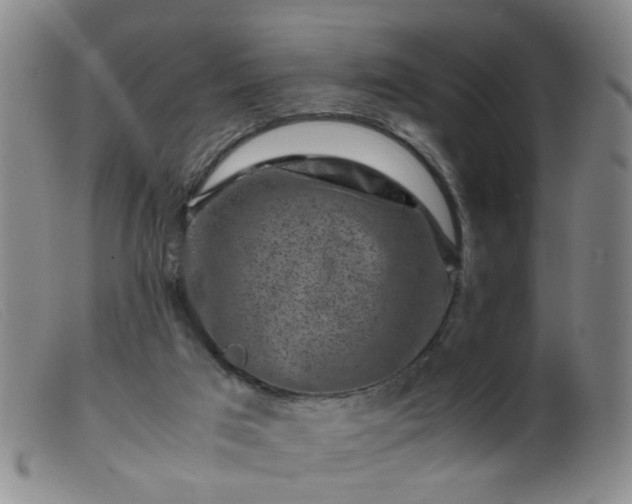 X0000099470017200805161122
