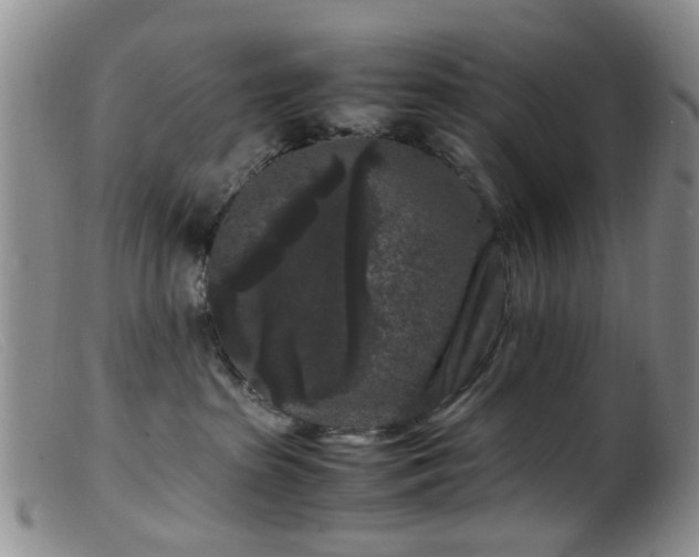 X0000099470285200805161118