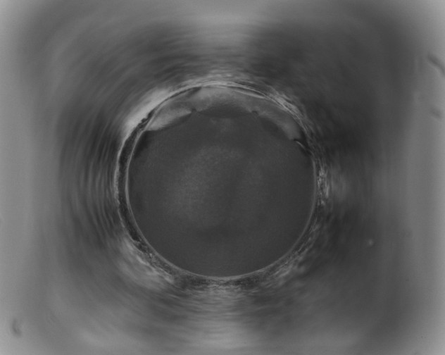 X0000099470292200805161118