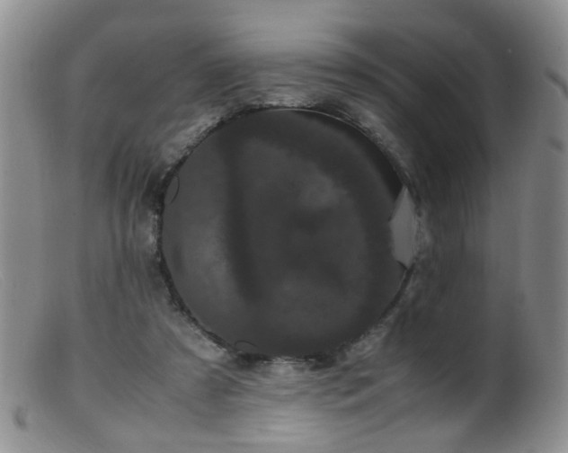 X0000099470305200805161117