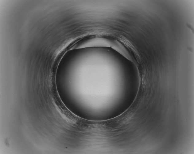 X0000099470436200805161114