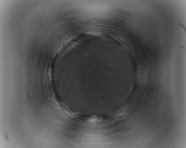 X0000099470504200805161114