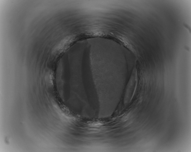 X0000099470643200805161112