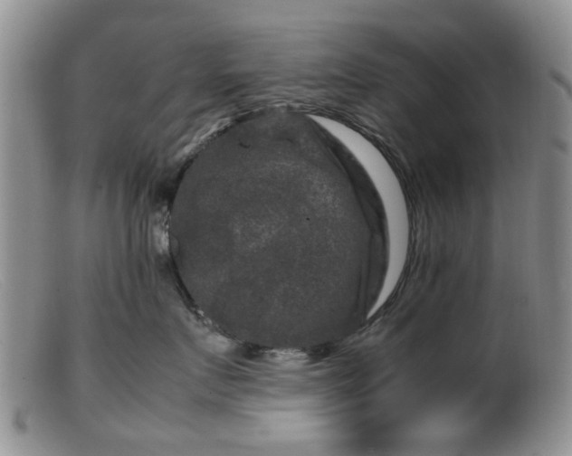 X0000099470719200805161111