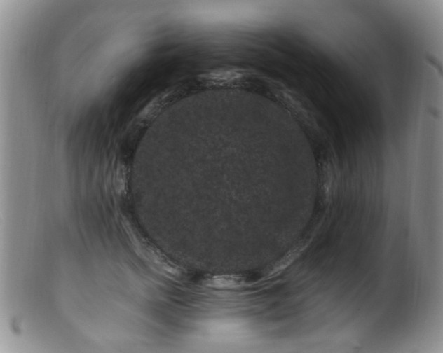 X0000099470758200805161111