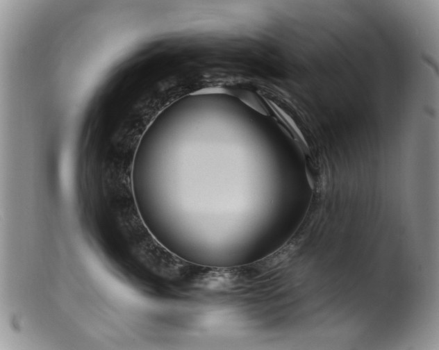 X0000099470764200805161111
