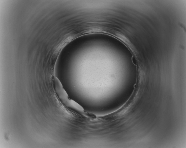 X0000099470857200805161109