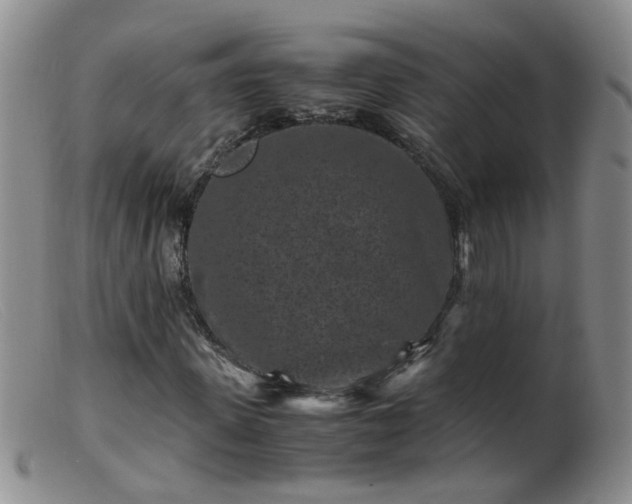 X0000099470915200805161107