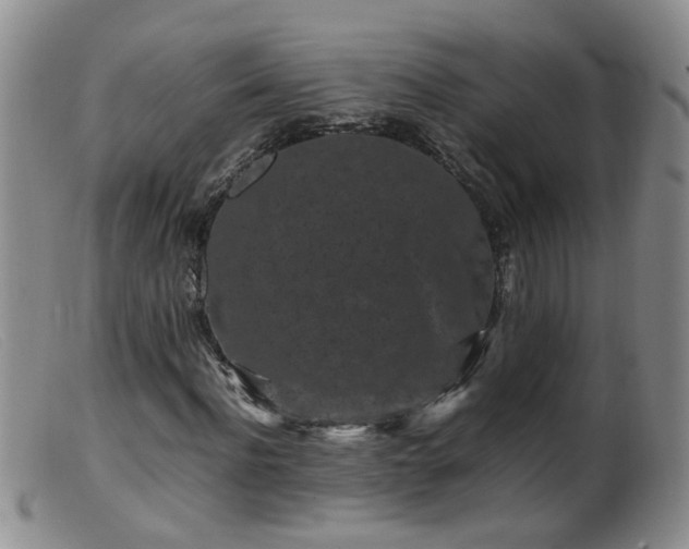 X0000099470916200805161107