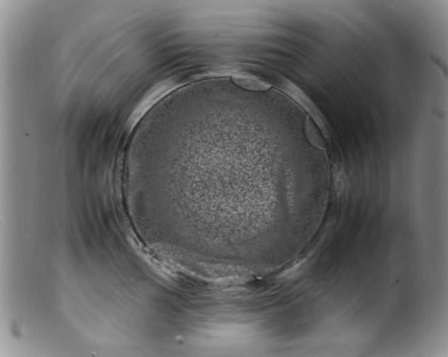 X0000099471002200805161106