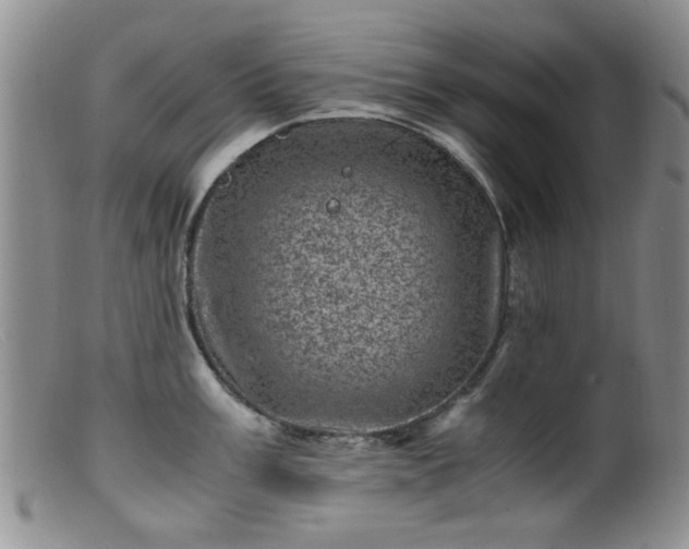 X0000099471003200805161106