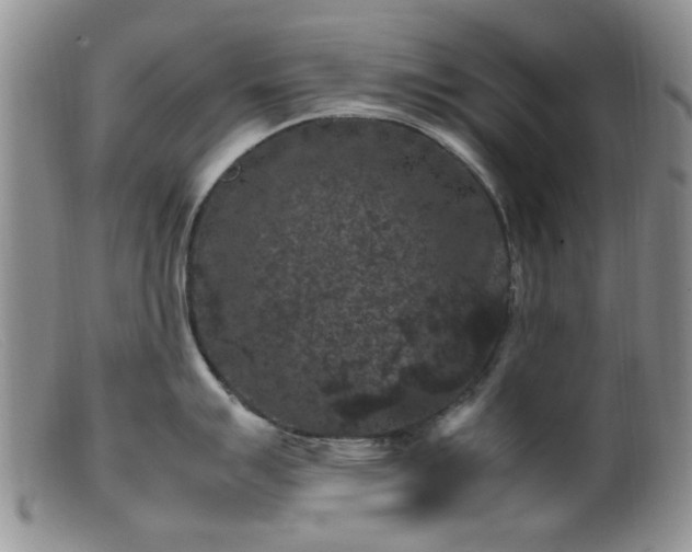 X0000099471007200805161106