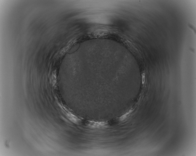 X0000099471011200805161106
