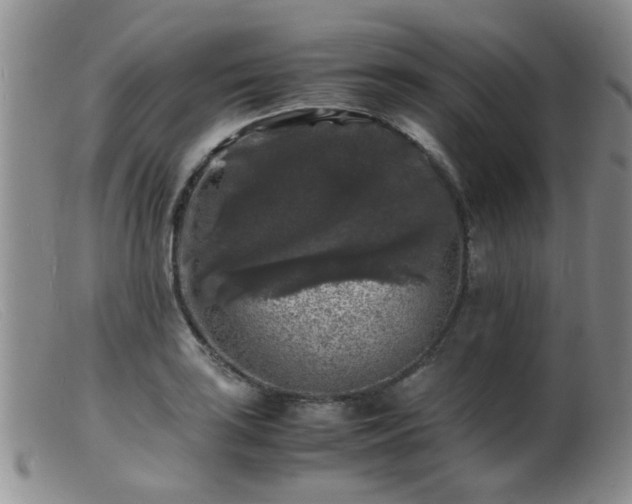 X0000099471035200805161106