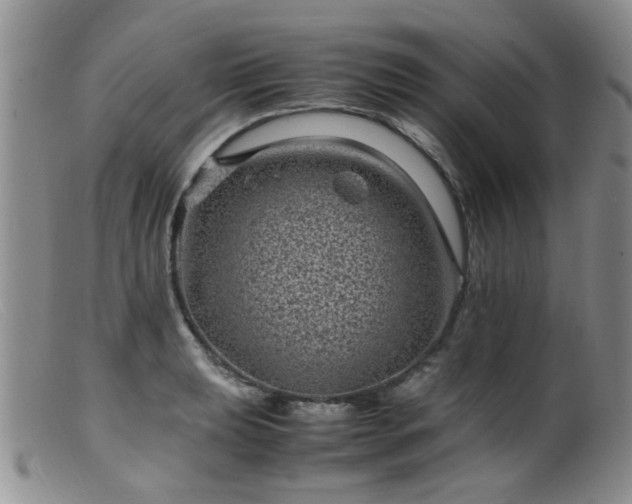 X0000099471039200805161106
